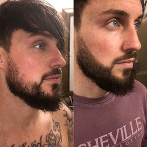 Adjustable Beard Filler Starter Kit for All Beards & Hairlines.